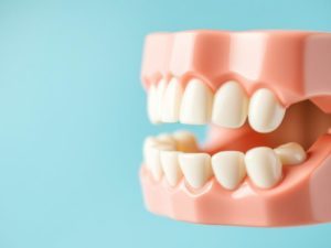 Керамические брекеты: идеальный баланс эстетики и эффективности